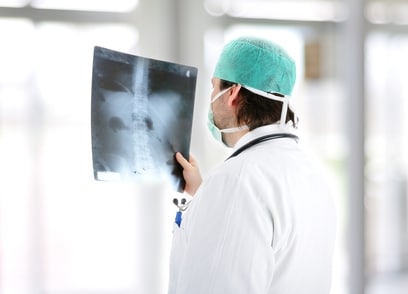 Doctor reading spinal x ray 1