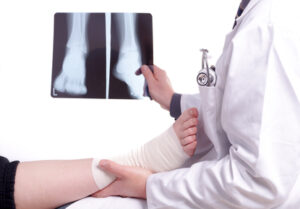 Doctor examines patients sprained foot while holding x ray