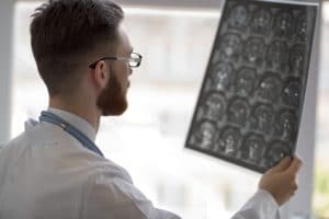 Doctor holding brain MRI