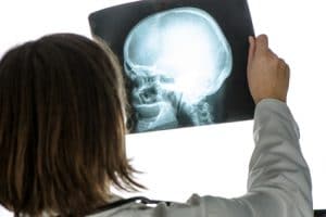 Doctor holding xray of human head and brain