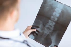 An injury at work can cause you to need hip replacement surgery