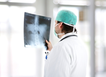 Doctor reading spinal x ray